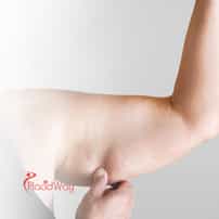 Thailand’s Popular Liposuction Options: A Budget-Friendly Choice for New Zealand Patients